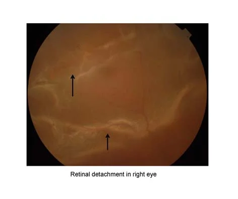 Importance Of Proper Pre Op Examination