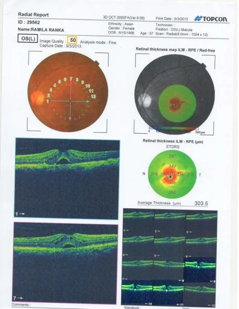 Role Of Optical Coherence Tomography